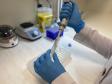 Governo apoia projeto de pesquisa em genética com foco na prevenção de doenças na população