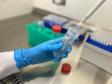 Governo apoia projeto de pesquisa em genética com foco na prevenção de doenças na população