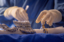 Humai-UEPG realiza cirurgia neurológica inédita em bebê de apenas sete meses