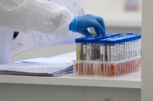 Casos de Covid-19 sobem 60% em uma semana e óbitos caem 23%
