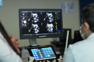 Huop adquire novo equipamento de ultrassom para Ala Covid-19