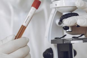UENP divulga resultado de pesquisa sobre a Covid-19 no Norte Pioneiro