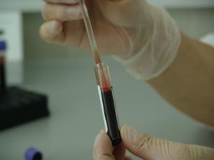 Projeto da Unicentro reforça prevenção ao HIV e Infecções Sexualmente Transmissíveis
