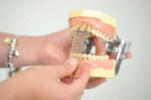 UEL licencia tecnologia para produção de novas ferramentas de odontologia restauradora