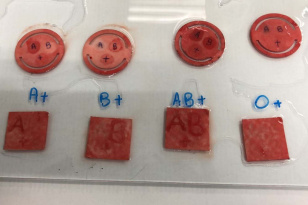 Apoio do Estado: curativo que identifica tipo sanguíneo em minutos passa por testes finais