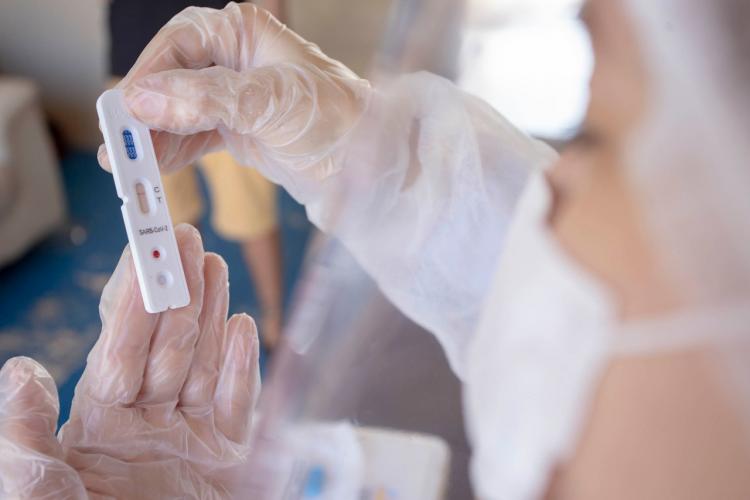 Estudo busca entender disseminação do vírus. Projeto será realizado em quatro etapas, em regiões diferentes da cidade