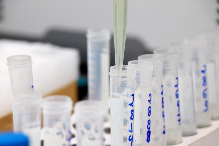 Tecpar lança edital para kits de diagnóstico da Covid e de outras doenças