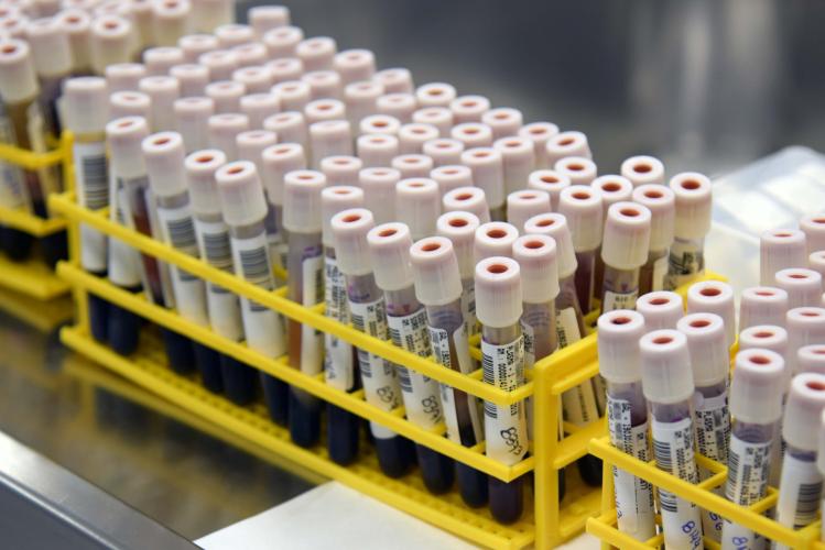 Estudo analisa relação de diagnóstico entre Covid-19 e a dengue