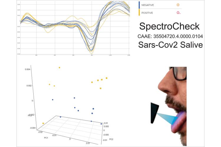 UEM e empresa de Maringá desenvolvem software inovador para triagem de Covid-19