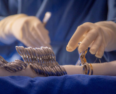 Humai-UEPG realiza cirurgia neurológica inédita em bebê de apenas sete meses