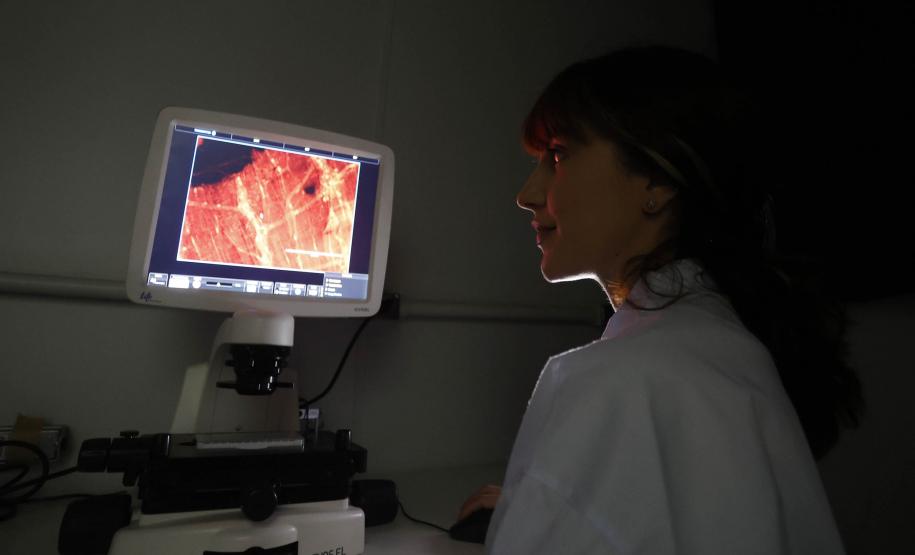 Estudos financiados pelo Estado pesquisam formas de aumentar o combate ao câncer em mulheres