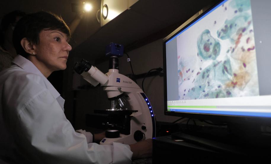 Pesquisadoras da UEM vão liderar projeto nacional de autocoleta de HPV