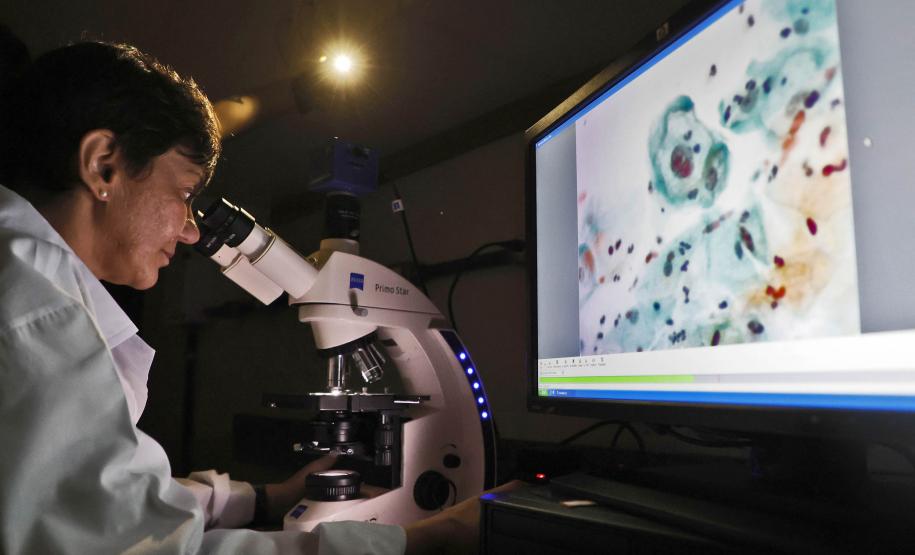 Pesquisadoras da UEM vão liderar projeto nacional de autocoleta de HPV