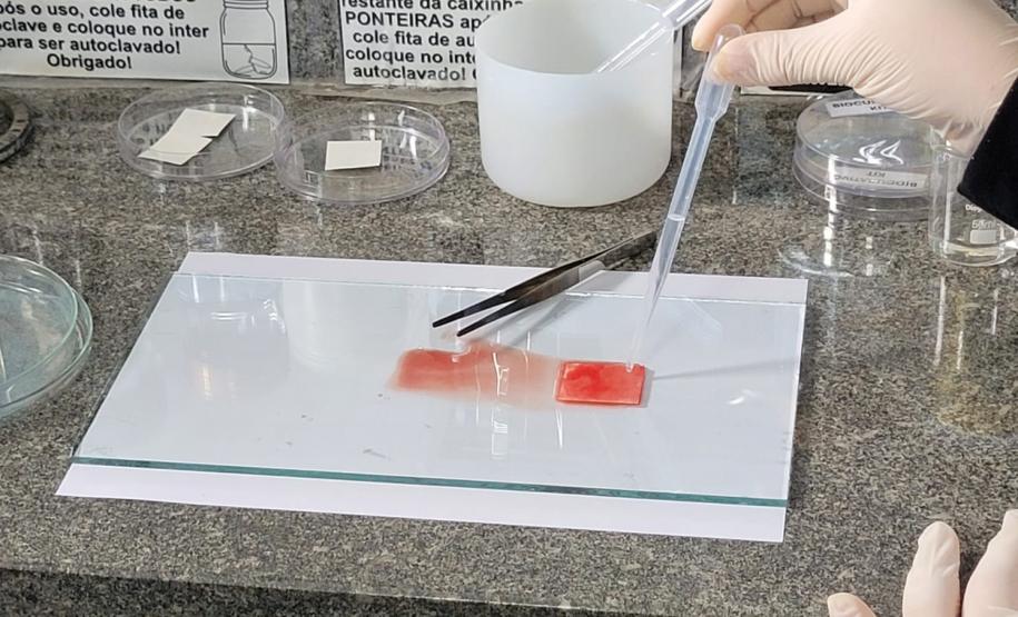 Produto desenvolvido na UEL determina o tipo sanguíneo em menos de dois minutos