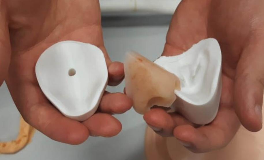 Startup apoiada pelo Governo produz digitalmente próteses faciais e biomodelos