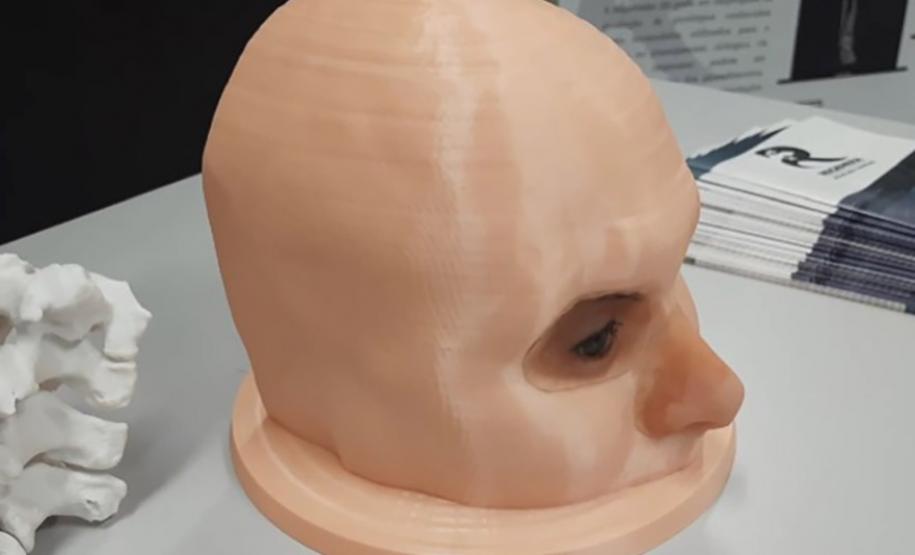 Startup apoiada pelo Governo produz digitalmente próteses faciais e biomodelos