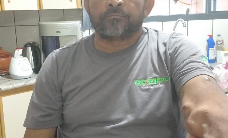 Startup apoiada pelo Estado cria simulador para treinamento de hemodiálise