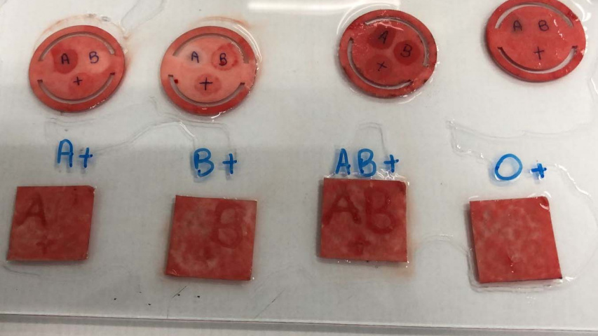 Apoio do Estado: curativo que identifica tipo sanguíneo em minutos passa por testes finais